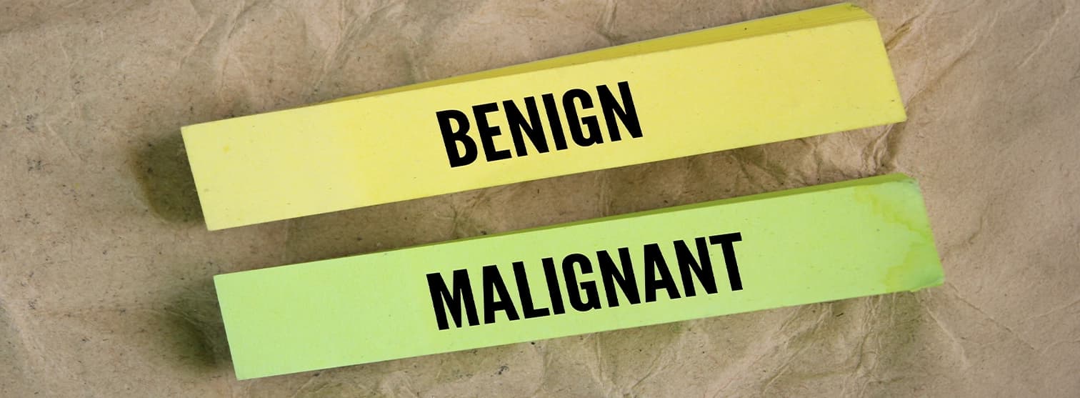 Benign vs malignant tumour comparison