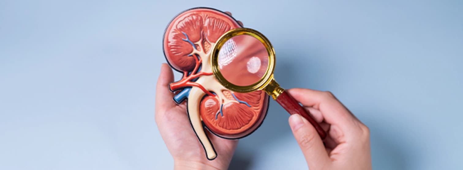 Kidney Stones Treatment for Cameroon Patients