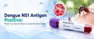 Dengue NS1 Antigen Positive: What Your Result Means & Essential Next Steps