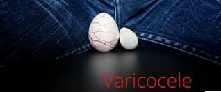 Varicocele Surgery: Symptoms, Male Infertility, Treatment & Recovery