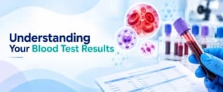 Blood Test Results Explained: Understanding Your Report, Reference Ranges and Common Tests