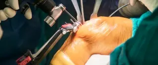Joint Replacement Surgery Abroad: A Complete Patient Guide From Surgery to Recovery