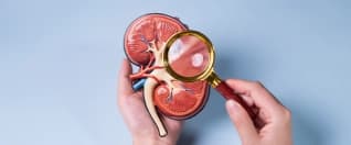 Kidney Stones Treatment for Cameroon Patients Diagnosis to Recovery