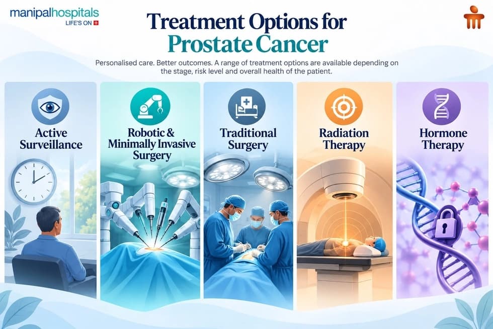 Treatment Options for Prostate Cancer Treatment Options for Prostate Cancer