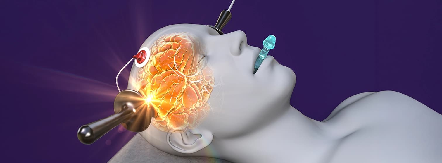 Deep Brain Stimulation Surgery for Parkinsons Deep Brain Stimulation Surgery for Parkinsons