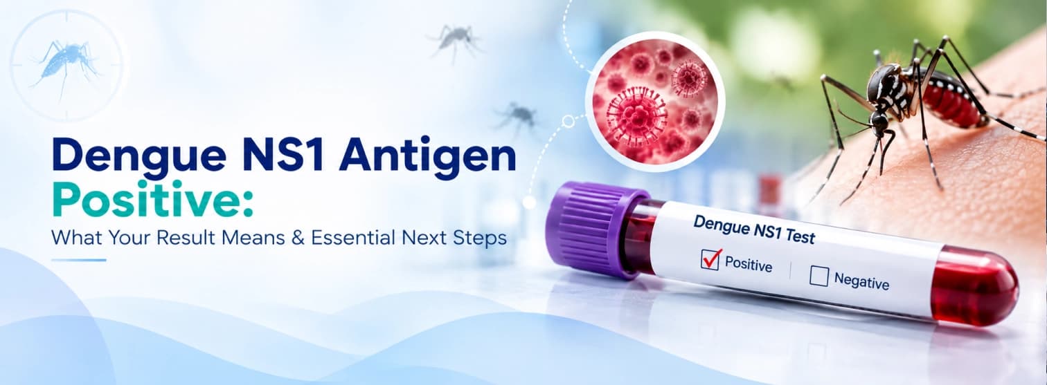 Dengue NS1 Antigen Positive: What It Means & Next Steps Dengue NS1 Antigen Positive: What It Means & Next Steps