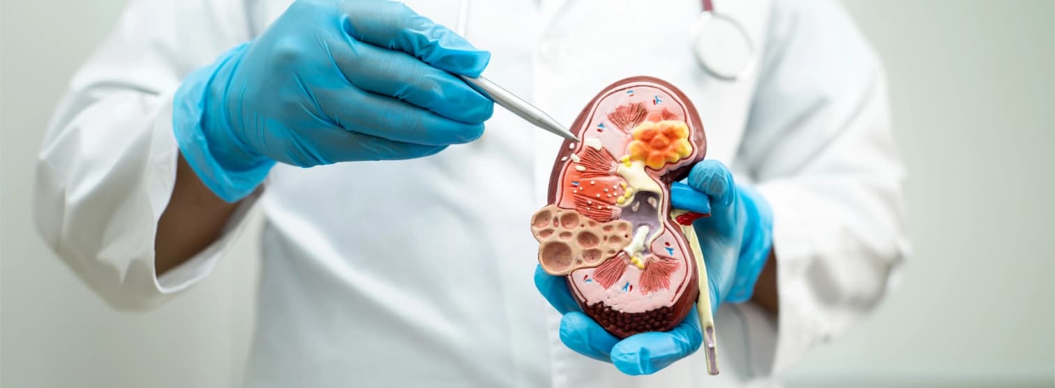 Chronic Kidney Disease Treatment Abroad Chronic Kidney Disease Treatment Abroad