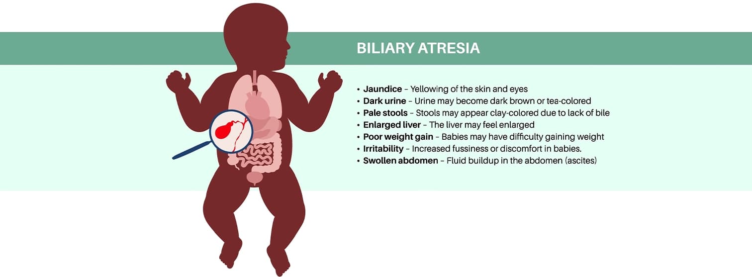 Paediatric Liver Transplant it's Challenges and Innovations