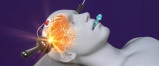 Deep Brain Stimulation (DBS) Surgery for Parkinson’s Disease: A Complete Guide Deep Brain Stimulation (DBS) Surgery for Parkinson’s Disease: A Complete Guide