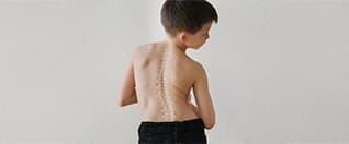 Does My Child Need Scoliosis Surgery? What Parents Should Know Does My Child Need Scoliosis Surgery? What Parents Should Know