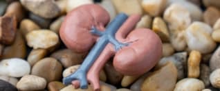 Kidney Stones Treatment Options for Global Patients Kidney Stones Treatment Options for Global Patients