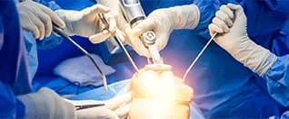 Knee Replacement Surgery for Mauritius Patients: Procedure to Recovery at Manipal Hospitals Global Knee Replacement Surgery for Mauritius Patients: Procedure to Recovery at Manipal Hospitals Global