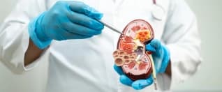 Chronic Kidney Disease Treatment to Recovery: A Guide for International Patients Chronic Kidney Disease Treatment to Recovery: A Guide for International Patients