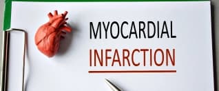 Myocardial Infarction Treatment for Cameroon Patients: Urgent Care, Procedures, and Recovery Myocardial Infarction Treatment for Cameroon Patients: Urgent Care, Procedures, and Recovery