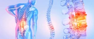 What Is OLIF Surgery and Why Should You Care? What Is OLIF Surgery and Why Should You Care?