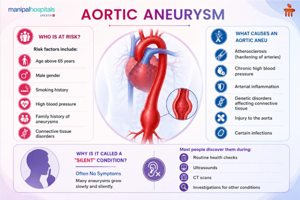 Aortic Aneurysm Risk Factors and Causes Aortic Aneurysm Risk Factors and Causes