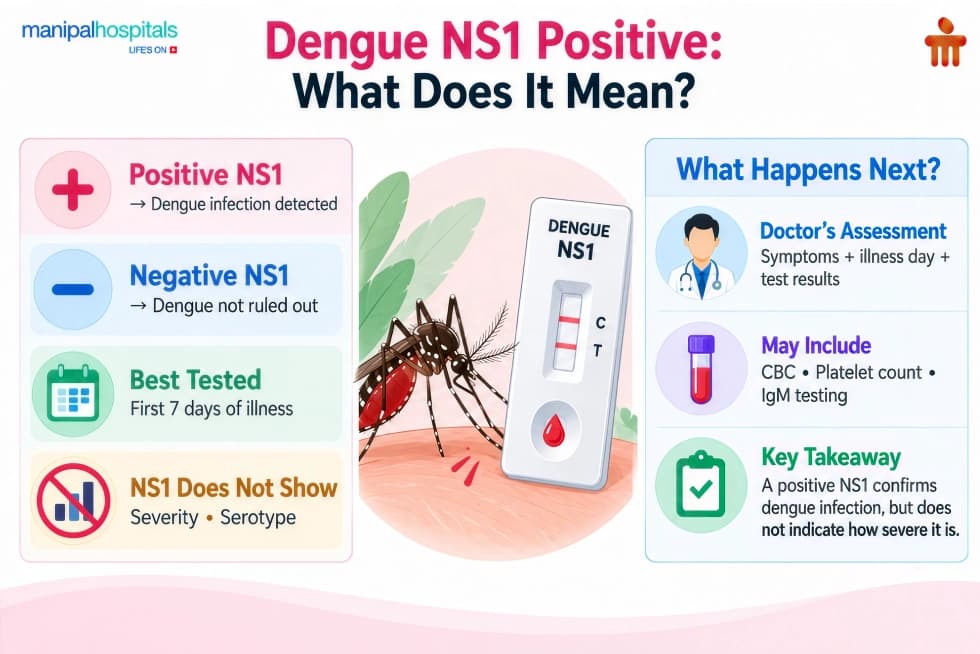 Dengue NS1 antigen test positive Explained Dengue NS1 antigen test positive Explained