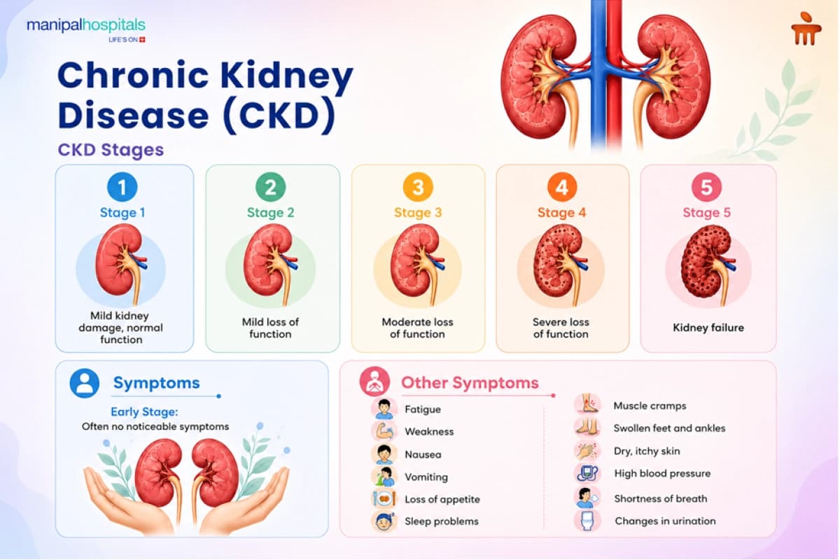 Chronic Kidney Disease: Stages and Symptoms Chronic Kidney Disease: Stages and Symptoms