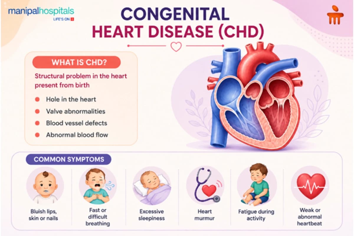 Congenital Heart Disease (CHD) Congenital Heart Disease (CHD)