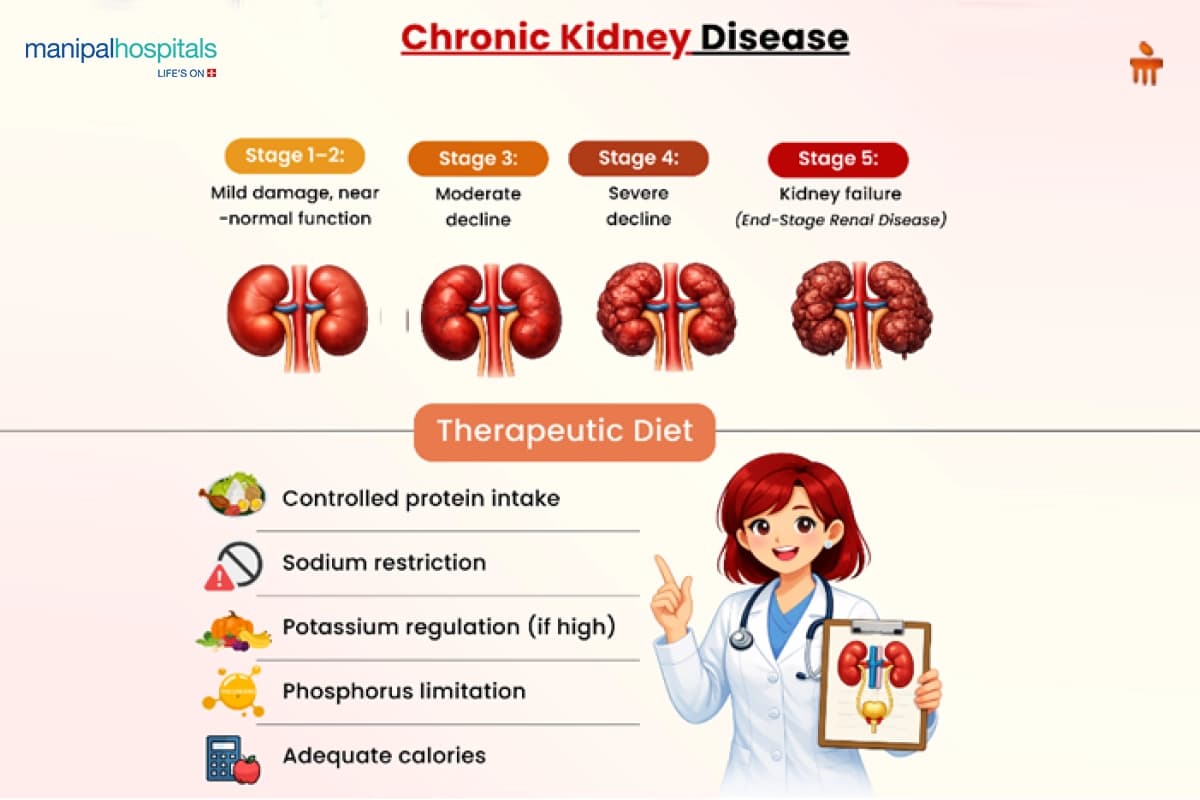 Chronic Kidney Disease Treatment Abroad Blog Media