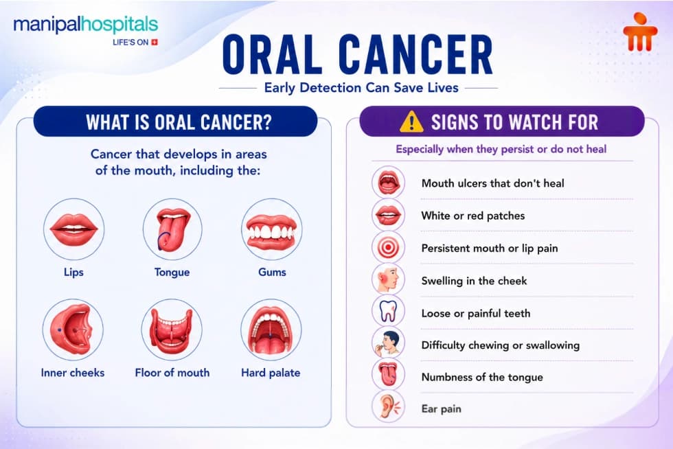 Oral cancer signs and symptoms to watch for Oral cancer signs and symptoms to watch for