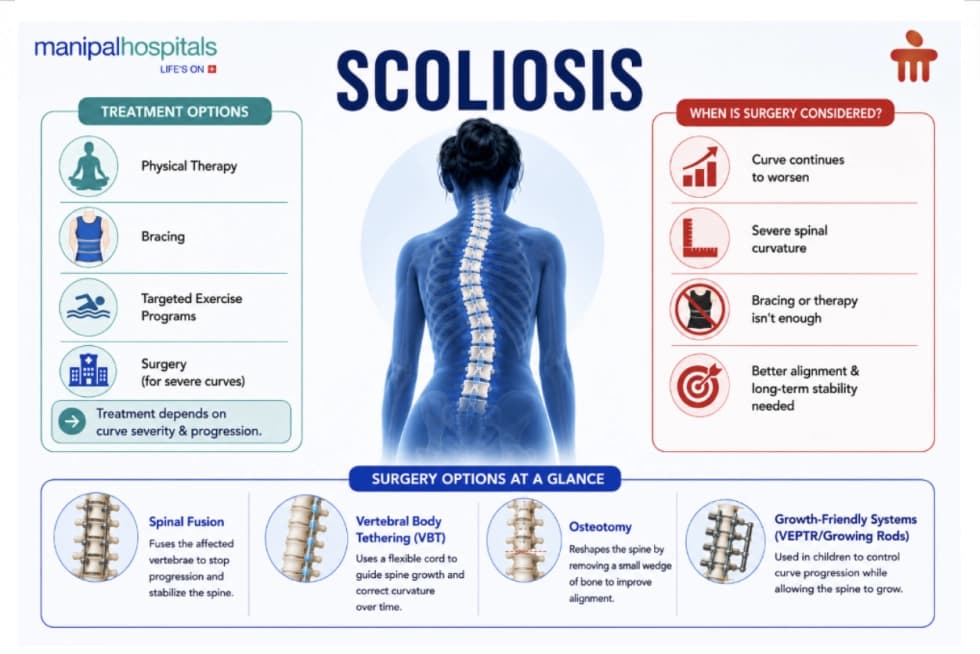 Scoliosis treatment and surgery options Scoliosis treatment and surgery options