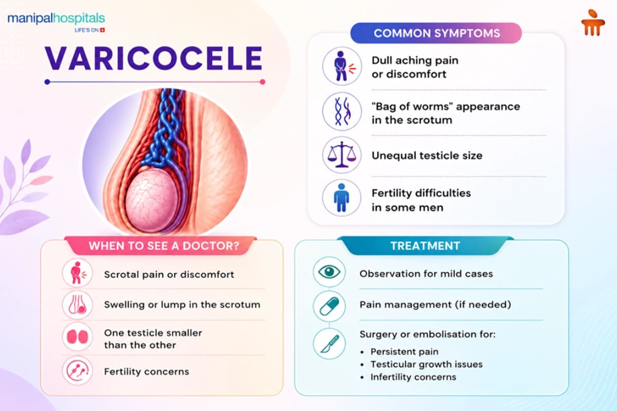 Varicocele symptoms, diagnosis, and treatment Varicocele symptoms, diagnosis, and treatment