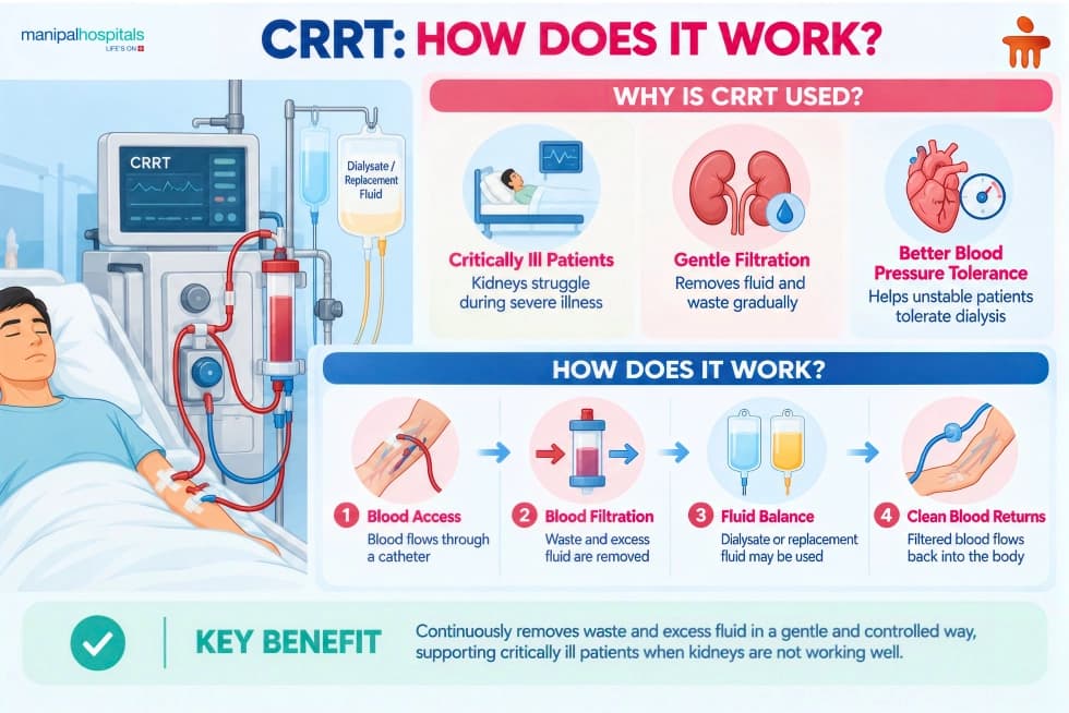 Continuous Renal Replacement Therapy: How does it Work? Continuous Renal Replacement Therapy: How does it Work?