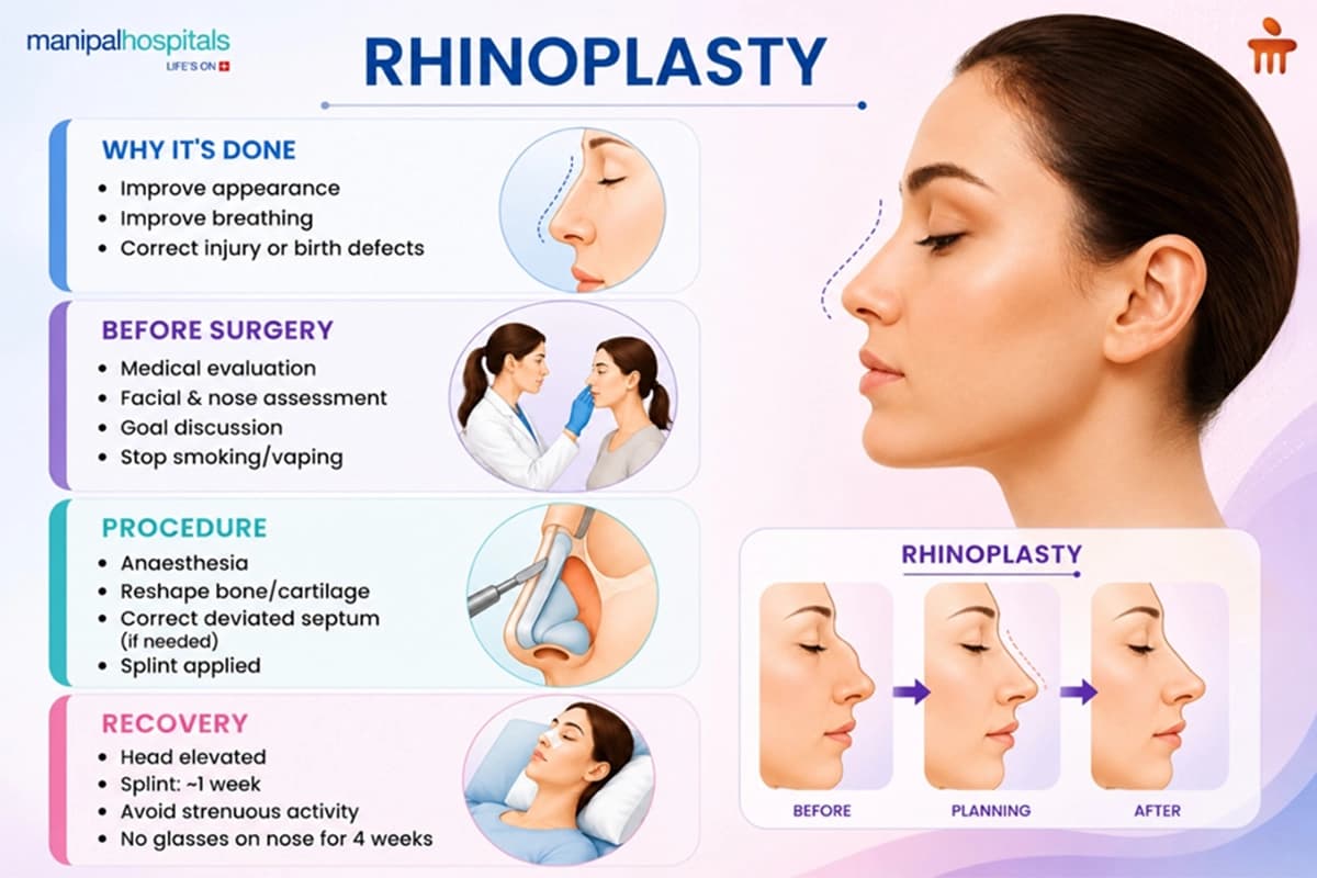 Rhinoplasty Surgery Procedures Rhinoplasty Surgery Procedures
