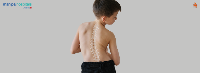 Does Your Child Need Scoliosis Surgery