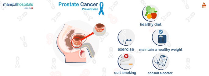 Prostate Cancer: Symptoms, Causes, Types, and Treatment