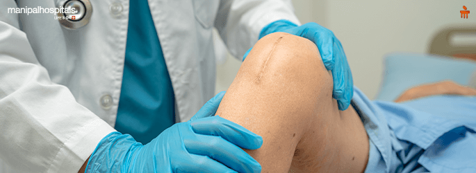 Total Knee Replacement: Causes, Signs, Symptoms & Treatments